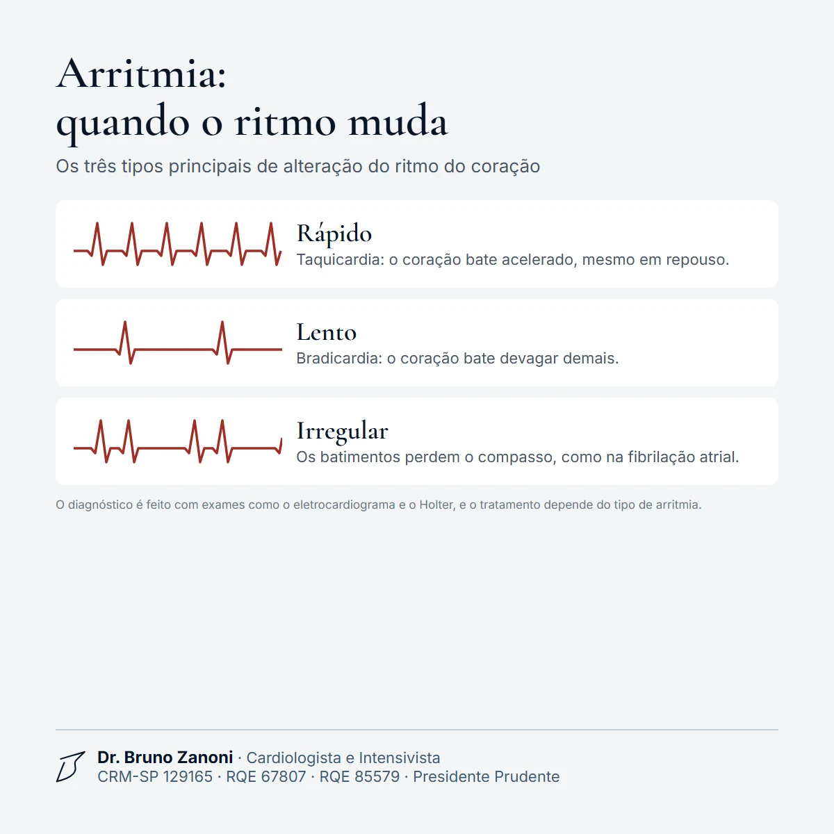 Tipos de arritmia cardíaca: ritmo rápido (taquicardia), lento (bradicardia) e irregular, como na fibrilação atrial, com traçados de exemplo